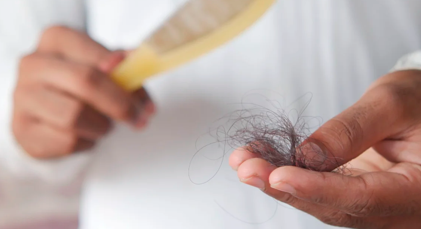 Matéria O Globo 1: Frio faz o cabelo cair? O que realmente acontece com os fios no inverno